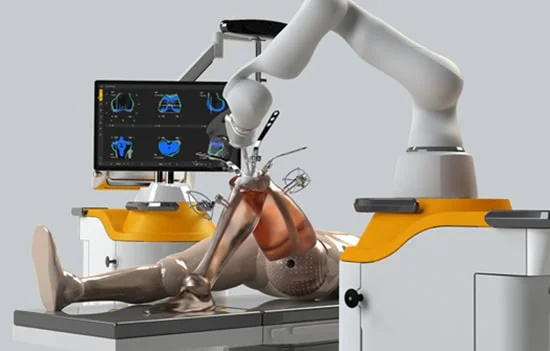 Robotic Knee Replacement Surgery